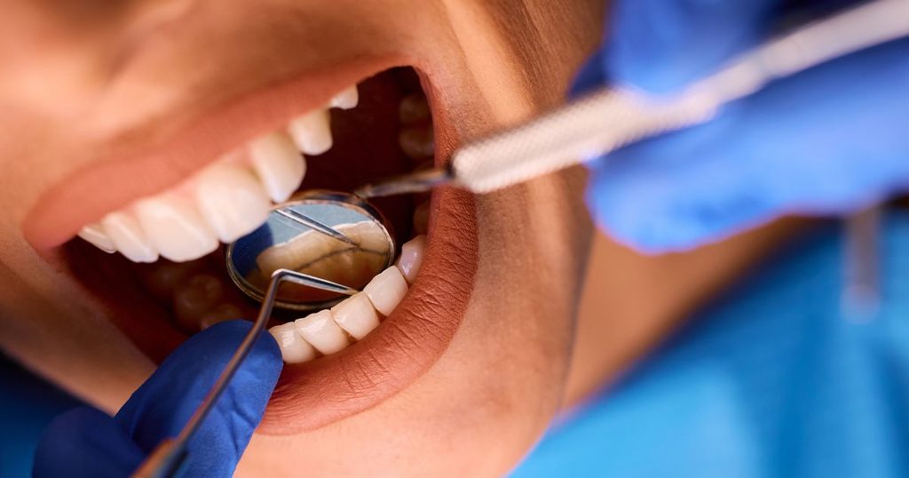 Limpieza dental profesional en City Clinic Marbella